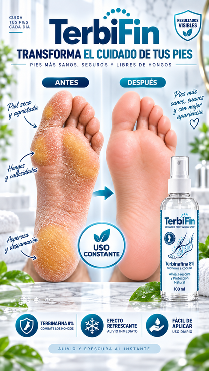 TerbiFin™ Spray Antihongos para Pies y Uñas